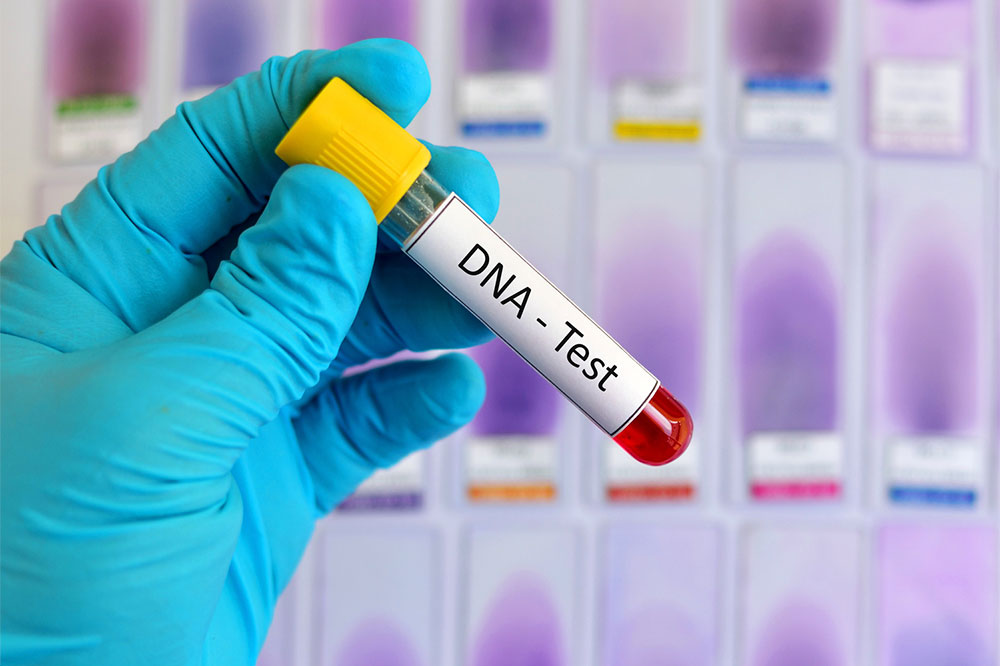 DNA Testing – Definition, Types, and Procedure