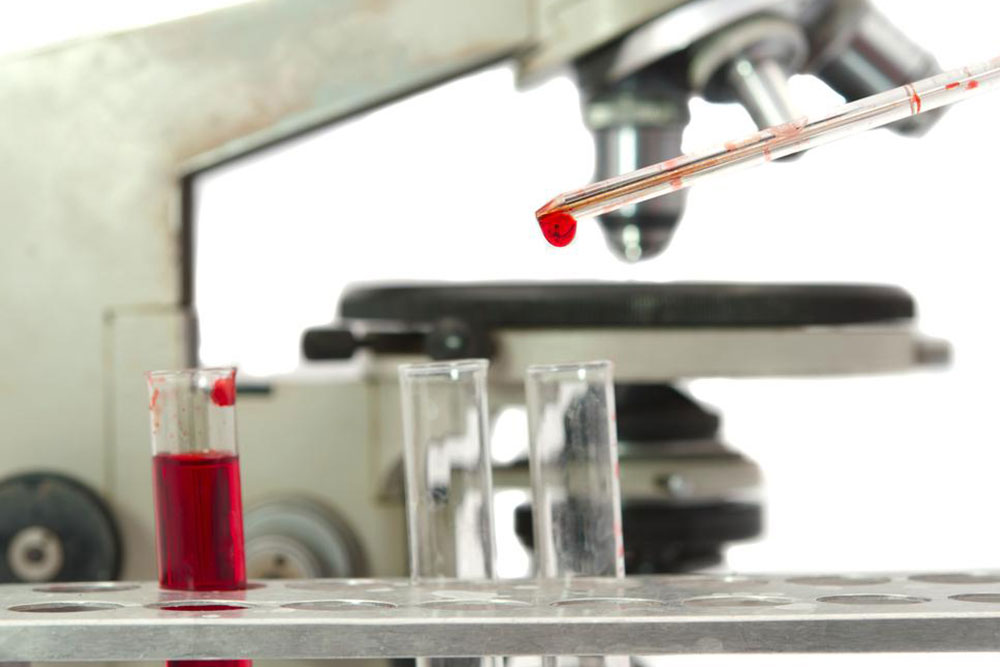 WBC count – Understanding the blood count