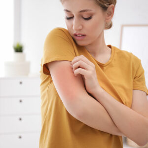 Allergies – Stages and prevention