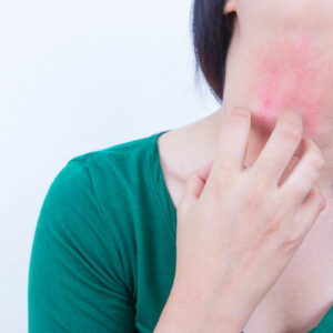 Postherpetic Neuralgia – Prevention and Treatment
