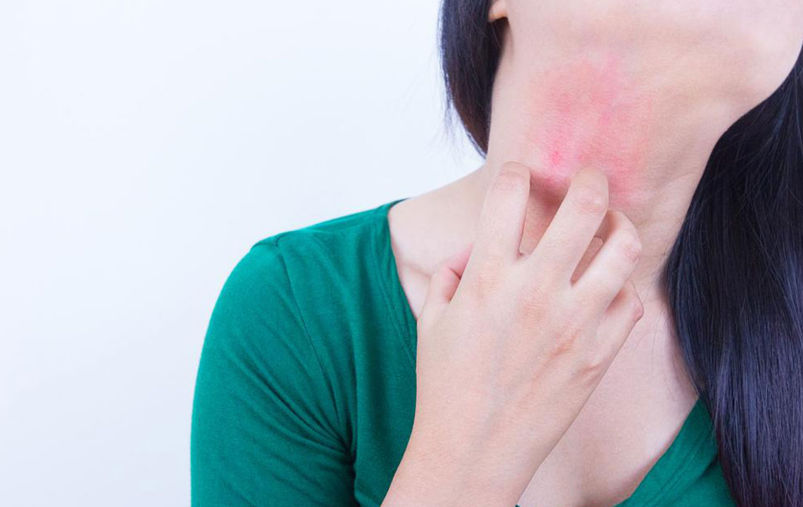 Postherpetic Neuralgia – Prevention and Treatment